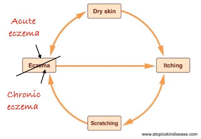 understanding-the-vicious-circle-chronic-eczema