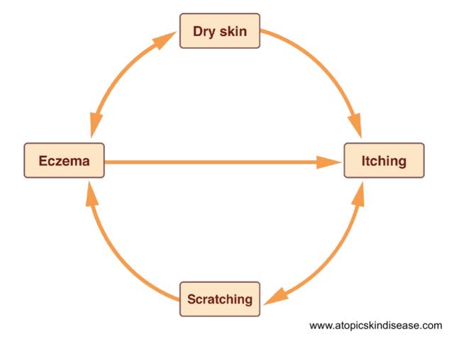 understanding-the-vicious-circle-chronic-eczema