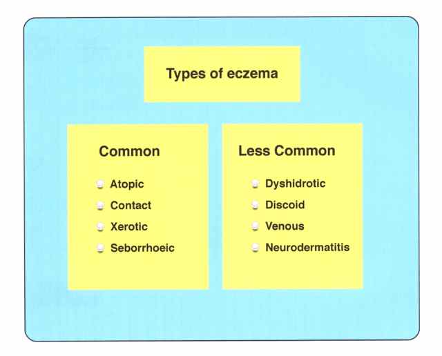 the-main-types-eczema