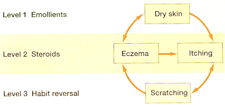 Topical-steroids-for-atopic-eczema