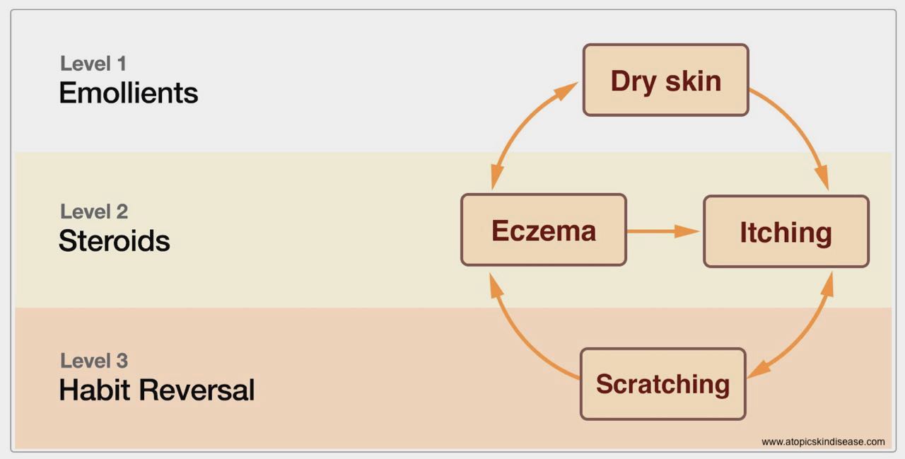habit-reversal-atopic-eczema-and-optimising-topical