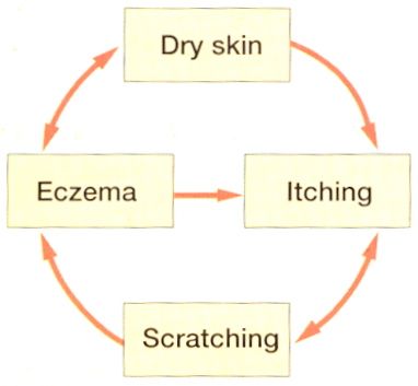 dry-skin-prevention-better-than-cure