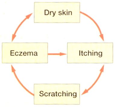 dry-skin-prevention-better-than-cure